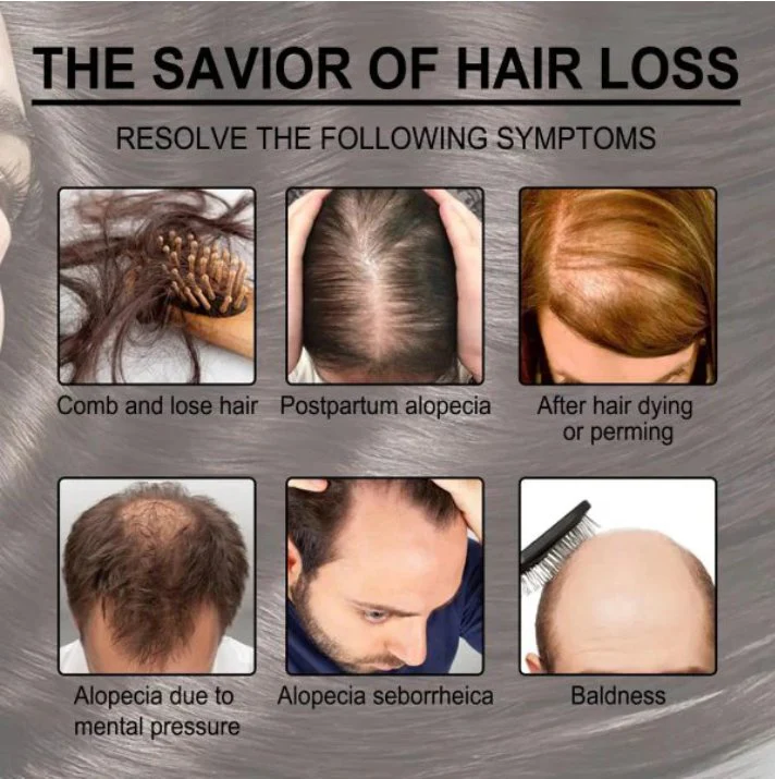 rosemary hair care essential oil rosemary hair care essential oil