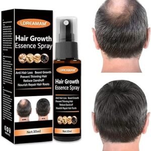 hair regrowth spray